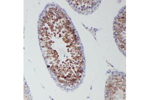 Anti-DDX4/MVH antibody, IHC(P) IHC(P): Rat Testis Tissue (DDX4 antibody  (Middle Region))