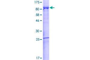 Afamin Protein (AFM) (AA 1-599) (GST tag)