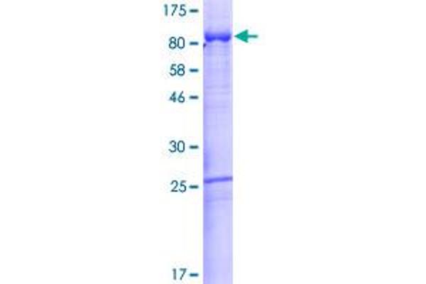 Afamin Protein (AFM) (AA 1-599) (GST tag)