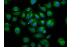 Immunofluorescence staining of A549 cells with ABIN7165321 at 1:100, counter-stained with DAPI. (LMAN1 antibody  (AA 154-329))