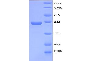 Chromosome 14 Open Reading Frame 2 (C14ORF2) (AA 1-58), (full length) protein (GST tag)