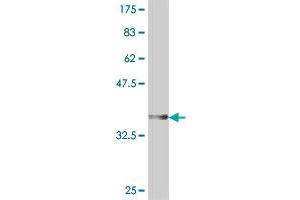 Western Blot detection against Immunogen (37 KDa) . (DPYSL4 antibody  (AA 461-559))
