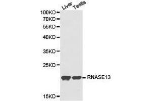 Western Blotting (WB) image for anti-Ribonuclease, RNase A Family, 13 (Non-Active) (RNASE13) antibody (ABIN1874615) (RNASE13 antibody)