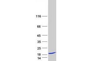 Western Blotting (WB) image for Tax1 (Human T-Cell Leukemia Virus Type I) Binding Protein 3 (TAX1BP3) protein (Myc-DYKDDDDK Tag) (ABIN2733250)