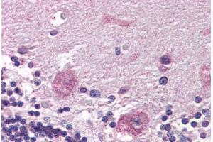 Human Brain, Cerebellum (formalin-fixed, paraffin-embedded) stained with PPP2R3A antibody ABIN337311 at 5 ug/ml followed by biotinylated anti-goat IgG secondary antibody ABIN481715, alkaline phosphatase-streptavidin and chromogen. (PPP2R3A antibody  (AA 1073-1085))