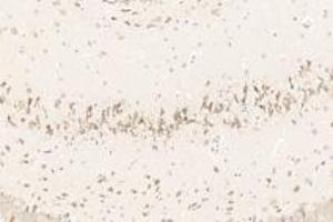Immunohistochemistry (Paraffin-embedded Sections) (IHC (p)) image for anti-Growth Differentiation Factor 6 (GDF6) antibody (ABIN7074132)