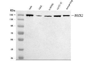 Western blot analysis of ROCK2 using anti-ROCK2 antibody (ABIN7602651).
