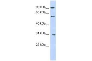 Image no. 1 for anti-Mannosyl (Alpha-1,6-)-Glycoprotein beta-1,2-N-Acetylglucosaminyltransferase (MGAT2) (AA 251-300) antibody (ABIN6743326) (MGAT2 antibody  (AA 251-300))