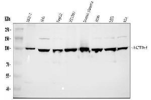 Western blot analysis of Alpha Actinin 4 using anti-Alpha Actinin 4 antibody (ABIN4886421).