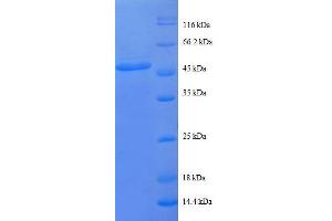 Proteasome (Prosome, Macropain) Subunit, beta Type 2 (PSMB2) (AA 1-201), (full length) protein (GST tag)