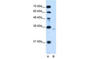 Image no. 1 for anti-Phosphatidic Acid Phosphatase Type 2A (PPAP2A) (AA 136-185) antibody (ABIN204986)