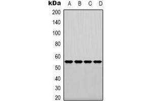 Western blot analysis of Fascin expression in HuvEc (A), K562 (B), HT29 (C), A549 (D) whole cell lysates. (Fascin antibody)