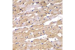 Immunohistochemistry of paraffin-embedded rat heart using PSEN2 antibody. (Presenilin 2 antibody)