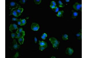 Immunofluorescent analysis of MCF-7 cells using ABIN7171522 at dilution of 1:100 and Alexa Fluor 488-congugated AffiniPure Goat Anti-Rabbit IgG(H+L) (GBL antibody  (AA 159-220))