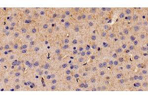 Immunohistochemistry (IHC) image for anti-Eukaryotic Translation Initiation Factor 2-alpha Kinase 3 (EIF2AK3) (AA 973-1114) antibody (ABIN7441241)