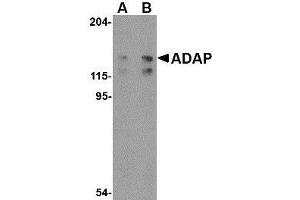 Western blot analysis of ADAP in K562 cell lysate with AP30019PU-N ADAP antibody at (A) 0.