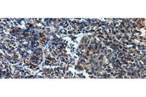 Immunohistochemistry of paraffin-embedded Human tonsil tissue using ATP1B2 Polyclonal Antibody at dilution of 1:25(x200)