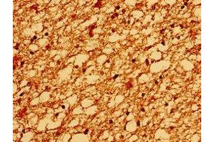 Immunohistochemistry of paraffin-embedded human brain tissue using ABIN7172938 at dilution of 1:100 (TM6SF2 antibody  (AA 290-331))