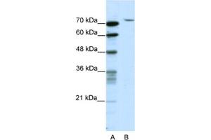 Western Blotting (WB) image for anti-TAF6 RNA Polymerase II, TATA Box Binding Protein (TBP)-Associated Factor, 80kDa (TAF6) antibody (ABIN2461761) (TAF6 antibody)
