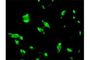 Immunofluorescence staining of human LNCaP cell colony with STEAP1 monoclonal antibody, clone J2D2 . (STEAP1 antibody  (AA 1-70))