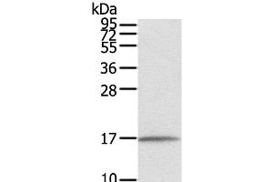 Western Blot analysis of Human normal liver tissue using EVA1A Polyclonal Antibody at dilution of 1:550 (TMEM166 antibody)