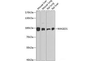 Western blot analysis of extracts of various cell lines using MAGED1 Polyclonal Antibody at dilution of 1:1000. (MAGED1 antibody)