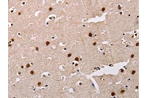 The image on the left is immunohistochemistry of paraffin-embedded Human brain tissue using ABIN7128323(AKAP8L Antibody) at dilution 1/20, on the right is treated with fusion protein. (AKAP8L antibody)