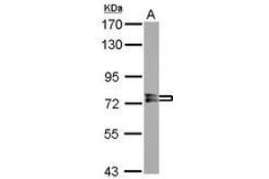 Image no. 2 for anti-Protein Phosphatase, EF-Hand Calcium Binding Domain 1 (PPEF1) (AA 361-650) antibody (ABIN1500360)