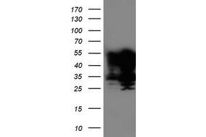 Western Blotting (WB) image for anti-T-Cell Acute Lymphocytic Leukemia 1 (TAL1) antibody (ABIN1501291) (TAL1 antibody)