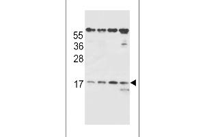 Western Blotting (WB) image for anti-T Cell Receptor beta Chain (TCRb) (AA 67-94) antibody (ABIN656127)