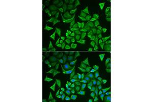 Immunofluorescence analysis of A549 cell using DTYMK antibody. (DTYMK antibody)