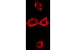 Immunofluorescent analysis of CAT1 staining in Hela cells. (SLC7A1 antibody)