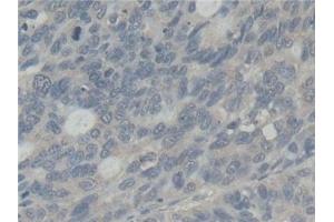 Immunohistochemistry (IHC) image for anti-Abl-Interactor 1 (ABI1) (AA 1-182) antibody (ABIN7436735)