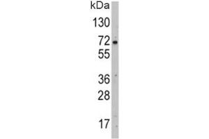 Western blot analysis of GLUT2 antibody and HepG2 lysate.