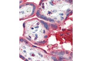 Formalin-fixed and paraffin-embedded human Placenta tissue reacted with OA1 antibody (N-term) 7414a , which was peroxidase-conjugated to the secondary antibody, followed by AEC staining. (APOA1 antibody  (N-Term))