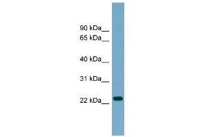 WB Suggested Anti-ARL8B Antibody Titration: 0. (ARL8B antibody  (Middle Region))