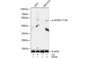Western blot analysis of extracts of 293T and NIH/3T3 cells, using Phospho-M1-T156 antibody (ABIN7265449) at 1:1000 dilution. (AP2M1 antibody  (pThr156))