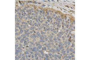 Immunohistochemistry (IHC) image for anti-Cytochrome P450, Family 1, Subfamily A, Polypeptide 1 (CYP1A1) (AA 200-460) antibody (ABIN3023076)