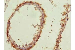 Immunohistochemistry of paraffin-embedded human testis tissue using ABIN7144386 at dilution of 1:100 (AP4B1 antibody  (AA 201-500))