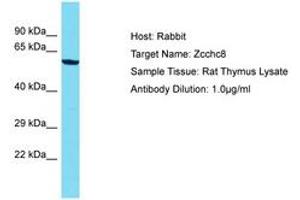 ZCCHC8 anticorps  (AA 246-295)