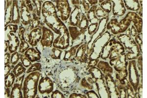 ABIN6278147 at 1/100 staining Mouse kidney tissue by IHC-P. (MAGEA1 antibody  (N-Term))