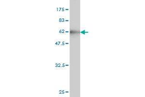Western Blot detection against Immunogen (56. (CBR1 antibody  (AA 1-277))