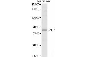Western blot analysis of extracts of mouse liver, using AFP antibody (ABIN5997204) at 1/1000 dilution. (alpha Fetoprotein antibody)