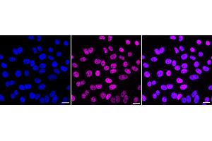 Immunocytochemical staining of HepG2 cells with METTL3 antibody (ABIN7799400), 1:1,000). (Recombinant METTL3 antibody)