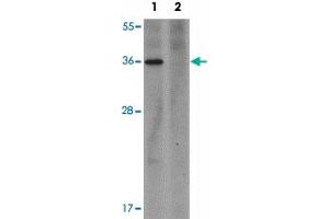 Western blot analysis of PLAC1 in human placenta tissue lysate with PLAC1 polyclonal antibody  at 1 ug/mL in (1) the absence and (2) the presence of blocking peptide.