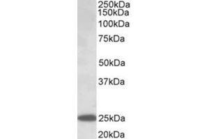 Western Blotting (WB) image for anti-Abhydrolase Domain Containing 14B (ABHD14B) (AA 188-200), (Internal Region) antibody (ABIN1105190) (ABHD14B antibody  (Internal Region))