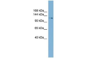 WB Suggested Anti-TTC17  Antibody Titration: 0. (TTC17 antibody  (N-Term))