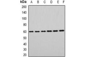 Western blot analysis of EYA3 expression in Hela (A), HT29 (B), mouse eye (C), mouse testis (D), rat brain (E), rat liver (F) whole cell lysates.