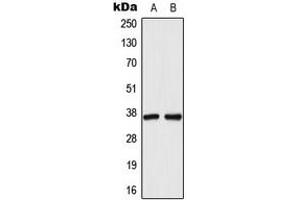 Western blot analysis of AKR1C1 expression in HeLa (A), HepG2 (B) whole cell lysates. (AKR1C1 antibody  (N-Term))