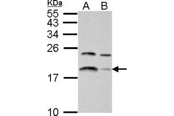 LC3B antibody